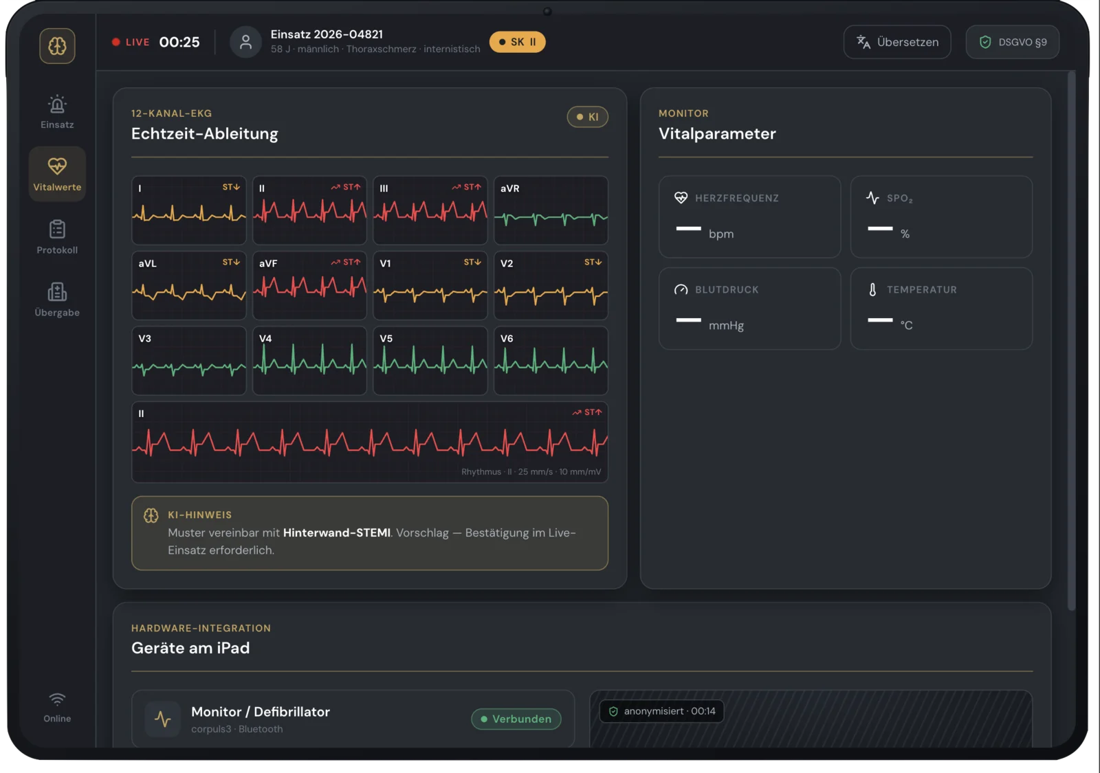AESKONdocs AI 12-Kanal-EKG-Raster mit Vitalparametern und KI-Hinweis auf einen Hinterwand-STEMI; Monitoranbindung als Zielarchitektur.